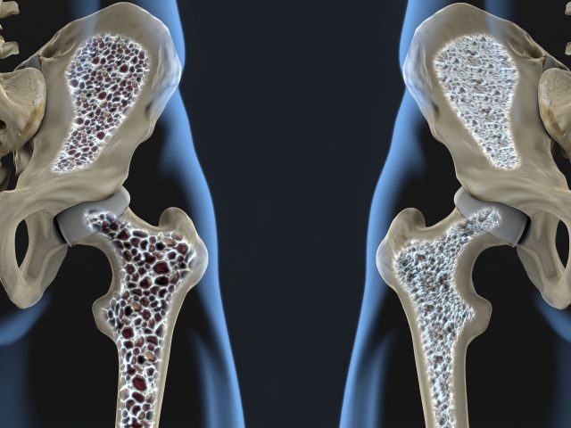 Echolight REMS Bone Scanning Device